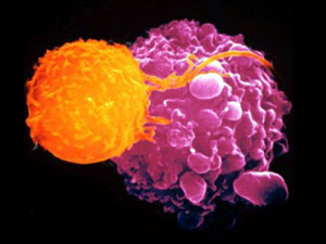Іммуцин - вакцина проти раку, Т-лімфоцит атакує ракову клітину