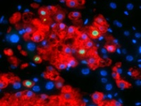 клітини печінки