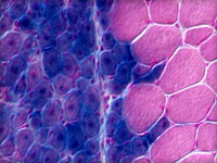 старіння стовбурових клітин